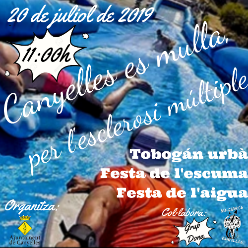 2019 07 20 Esclerosi